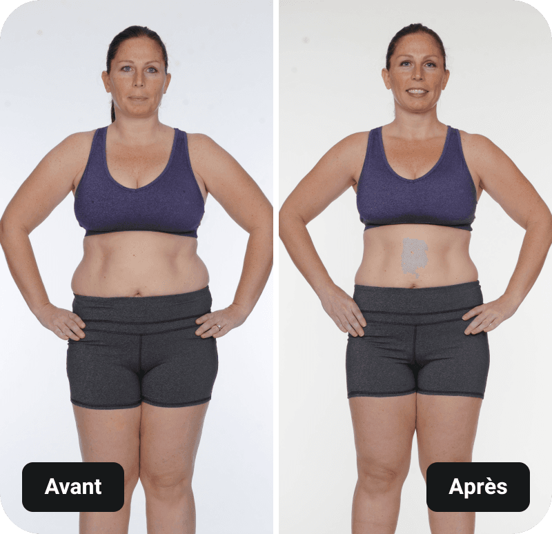 Xtend Barre results before and after