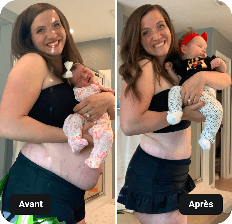 Pre & Post Natal Barre Blend results before and after